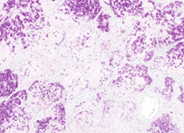 Ziehl-Neelsen stain